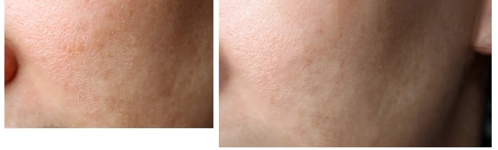 bareluxe face scrub before and after - crystal polishing balm